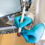 MasSpec Pen: a caneta brasileira que revoluciona o diagnóstico de câncer em tempo real