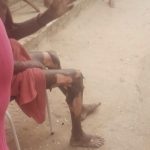 Vídeo: explosão de gás no início do sábado causa desastre e fere morador no Cristo, João Pessoa (PB)