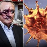 A fronteira final da oncologia: o cerco ao câncer de pâncreas