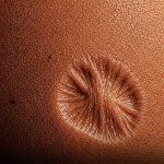 A marca indelével da imunização: por que vacinas de décadas atrás deixavam cicatrizes?